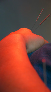 acupuncture-reviews